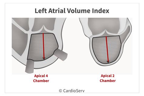 left atrial volume index chart.